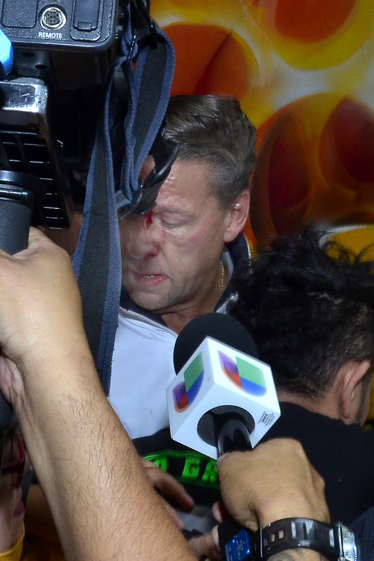 En entrevista con Gustavo Adolfo Infante en el programa 'Sale el Sol', el histrión dio su versuión de los hechos.