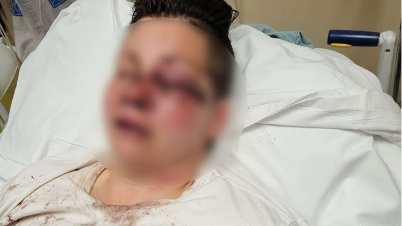 <a href="https://www.univision.com/local/houston-kxln/jennifer-lozano-walmart-houston" target="_blank">Jennifer Lozano</a> cuenta que fue atacada cuando se detuvo en el estacionamiento de un Walmart al suroeste de Houston. Pero, ¿cómo ocurrió?