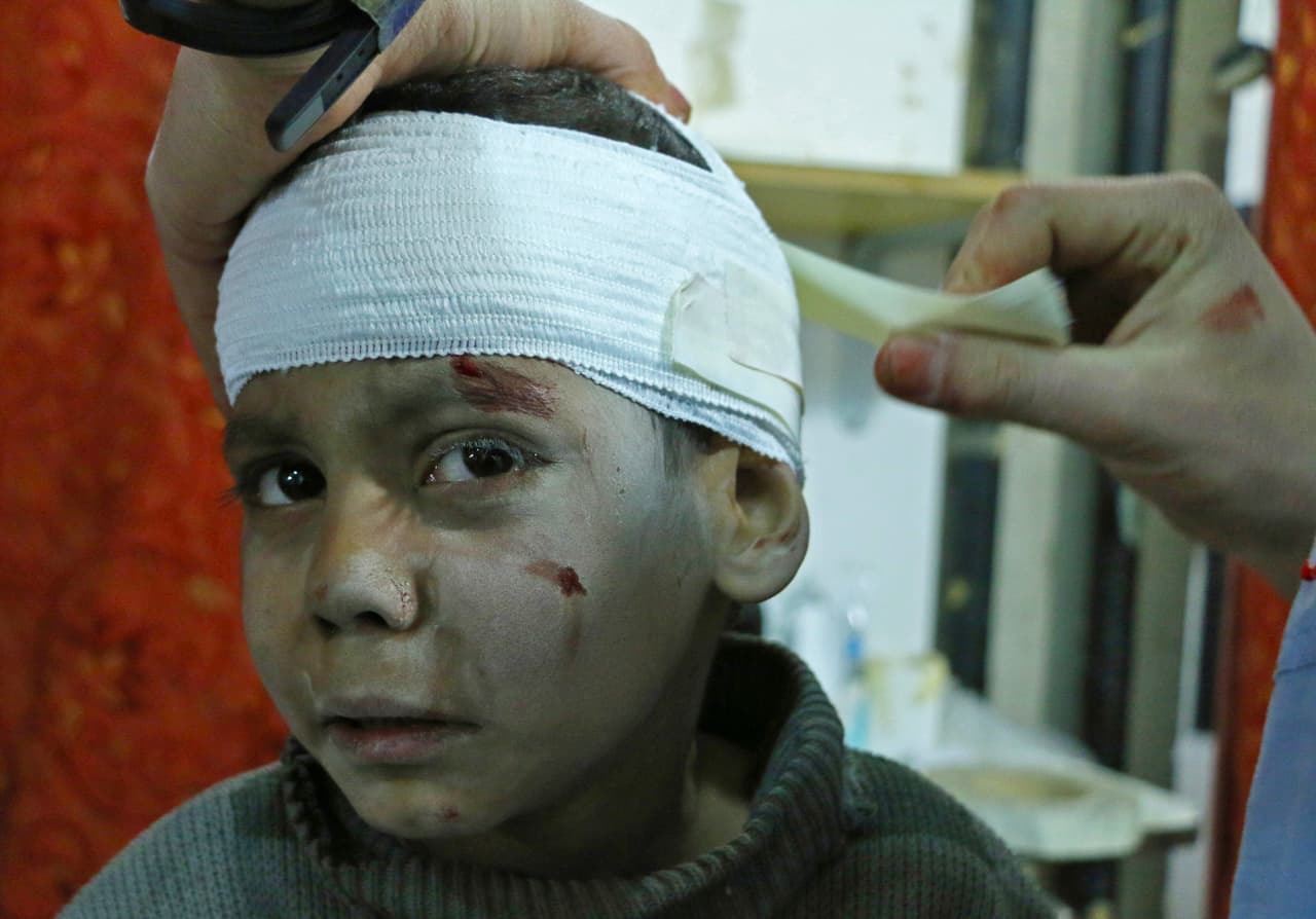 6 de marzo. Hossam Hawari, de 8 años, es tratado por heridas de ametralladora en un hospital de campaña improvisado en Kafr Batna tras los ataques aéreos del gobierno sirio en áreas controladas por los rebeldes.