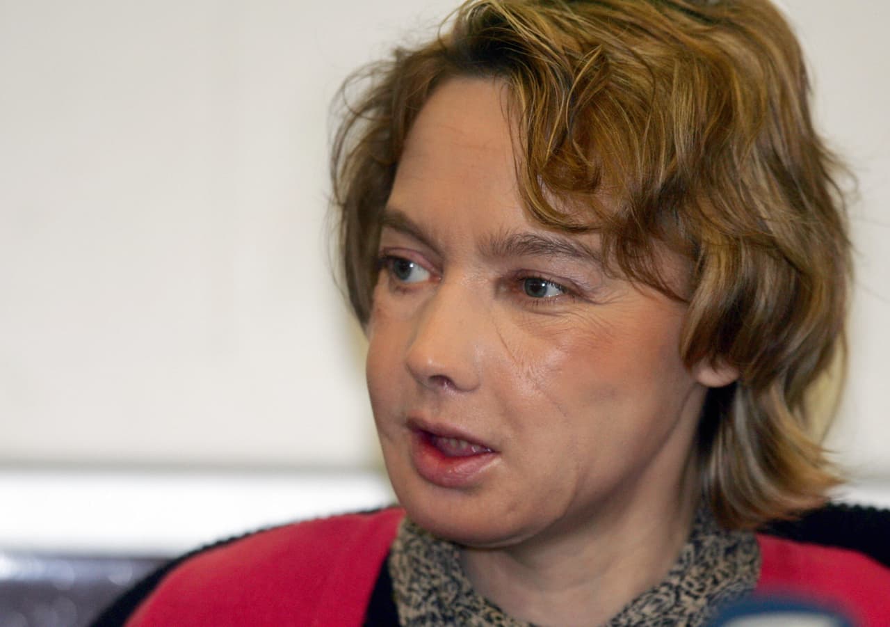 Pacientes como Dinoire deben consumir medicamentos inmunosupresores toda su vida, los cuales pueden aumentar el riesgo de cáncer y dañar otros órganos