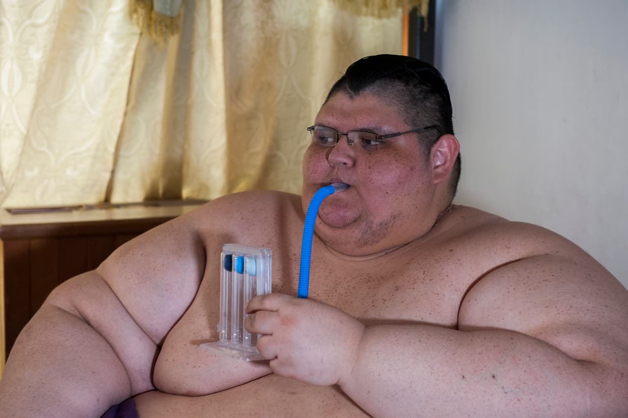 En octubre de 2016 el mexicano
<b>Juan Pedro Franco</b>, de 32 años,
<b>pesaba 1,312 libras</b> y debía permanecer conectado a un tanque de oxígeno.