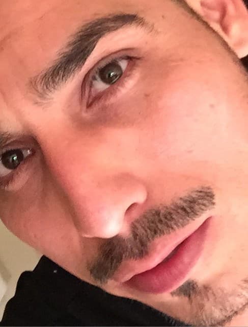 Recordemos que al principio usaba 'brackets', pero todo era para tener una sonrisa perfecta.