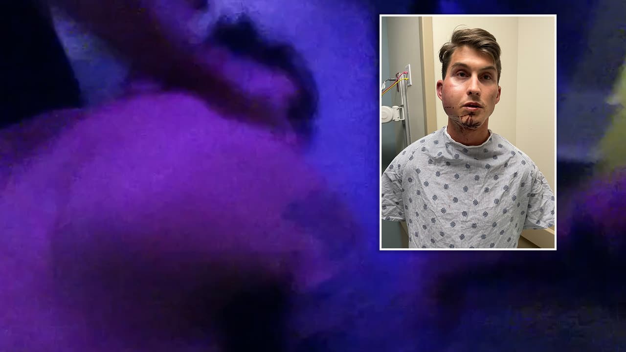 Presentan demanda contra la ciudad de Austin y tres policías por uso de fuerza excesiva 