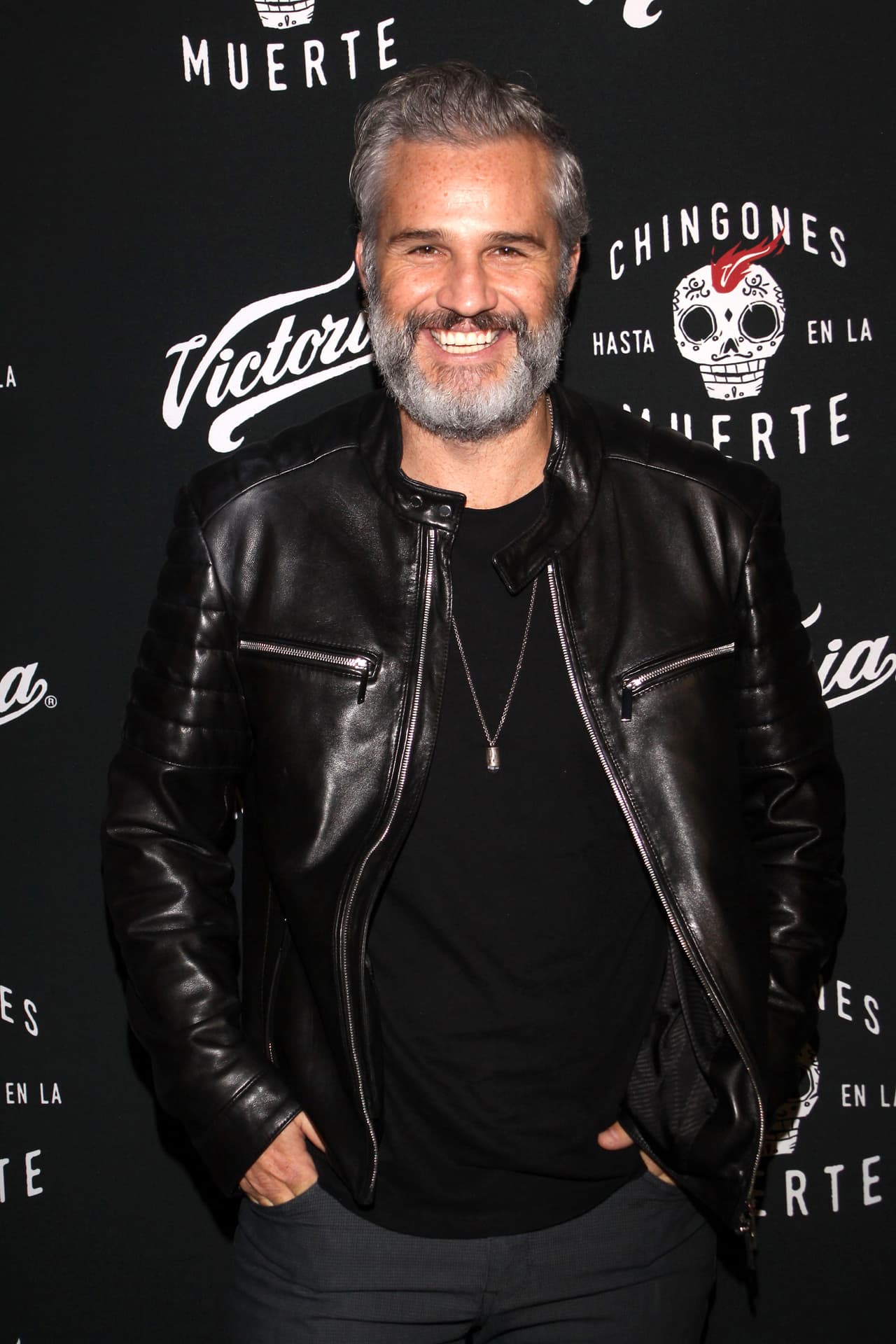 “Estoy muy agradecido, todo este tiempo he sentido mucho amor. Soy muy afortunado de tener la familia que tengo, la novia que tengo, todos los amigos y toda la gente que me ha apoyado de verdad”, expresó en su primera aparición ante los medios de comunicación tras revelar que usa una prótesis.