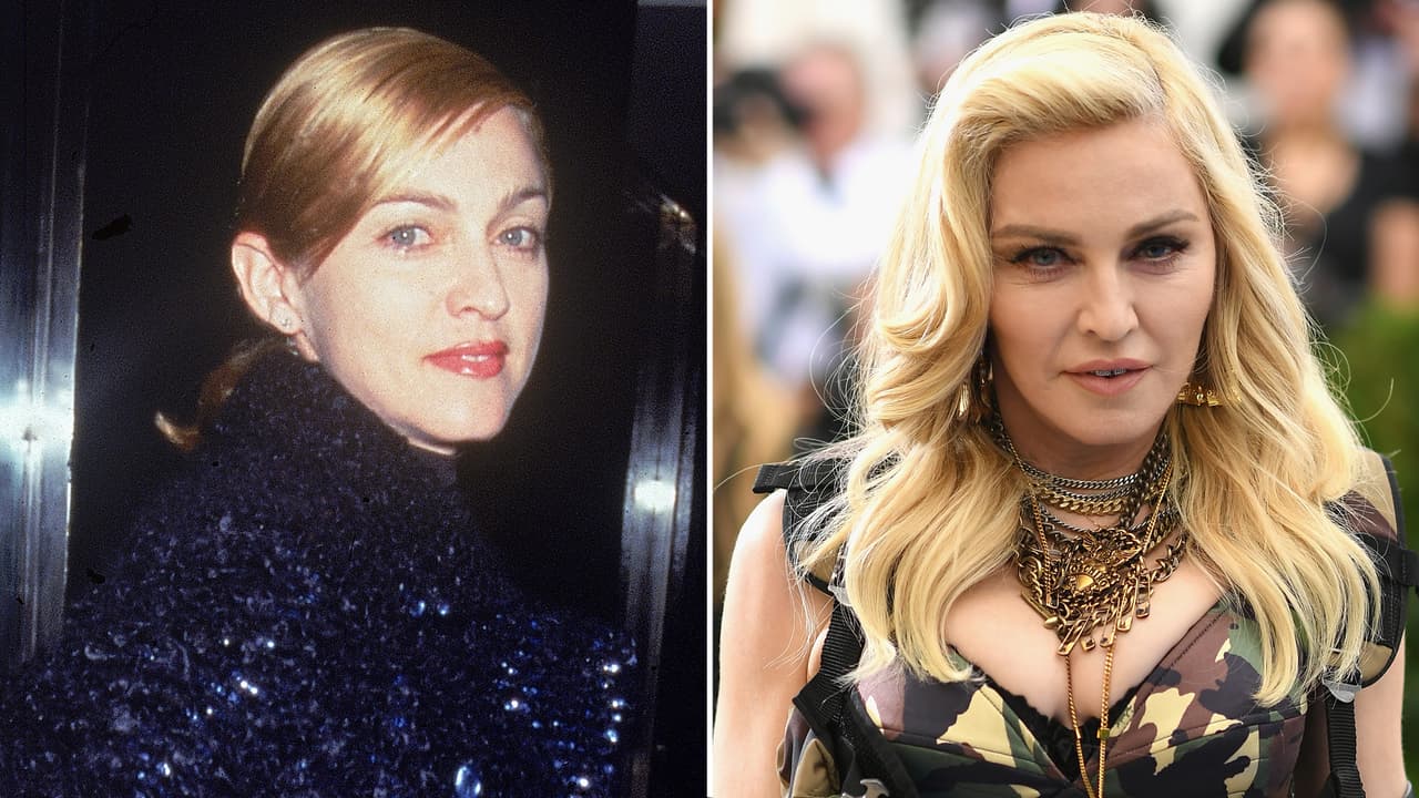La chica material, Madonna, es otra que no ha podido detener las agujas del reloj. A la cantente de 59 años siempre se le ha acuñado que no sólo se ha arreglado la nariz, sino también los pómulos, los ojos y hasta la frente.