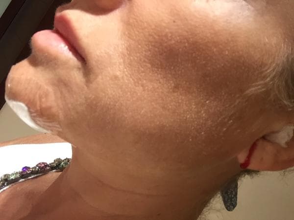 La actriz compartió en twitter una foto de la herida que su caída le provocó.