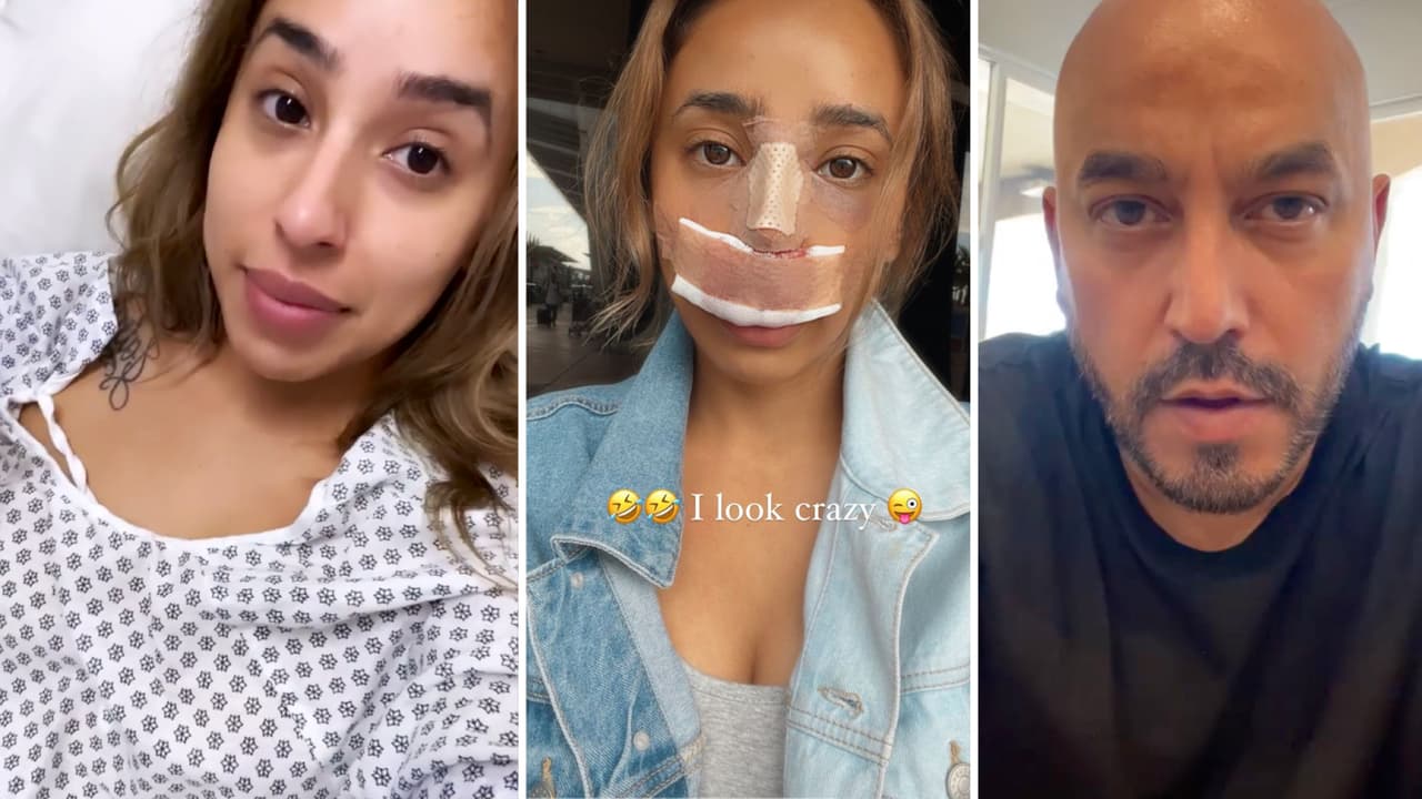 La hija de Lupillo Rivera se hizo la rinoplastia porque se "burlaban” de su nariz