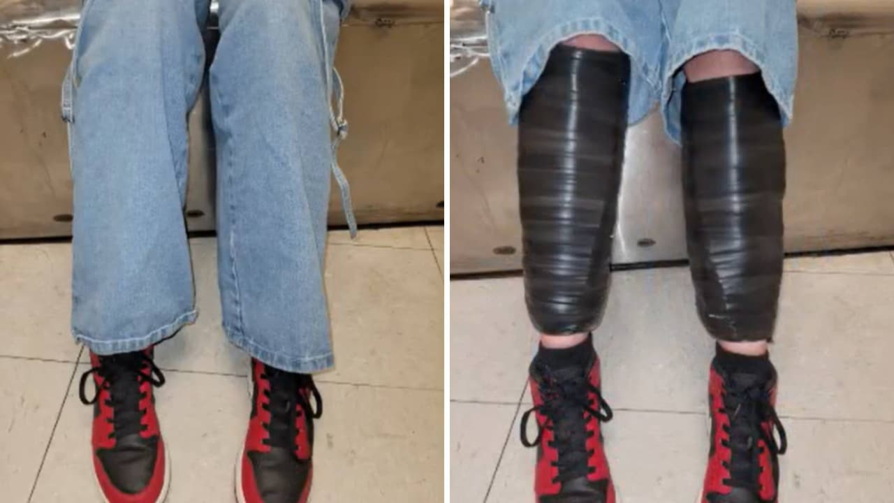 ¿Qué tenían estas piernas que causaron conmoción en la frontera?