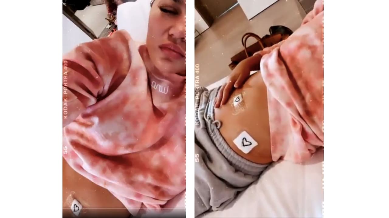 “Mi pequeño Jack habría nacido esta semana, así que no me siento bien. Realmente siento patadas en mi vientre, pero no es un fantasma. Me operarán de 
<b>endometriosis</b> mañana... pero la sensación del período este mes es exactamente como patadas de bebé”, escribió en Twitter el 3 de febrero de 2021.