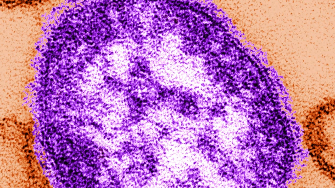 Declaran brote de sarampión en Los Ángeles tras confirmar cinco casos en el condado