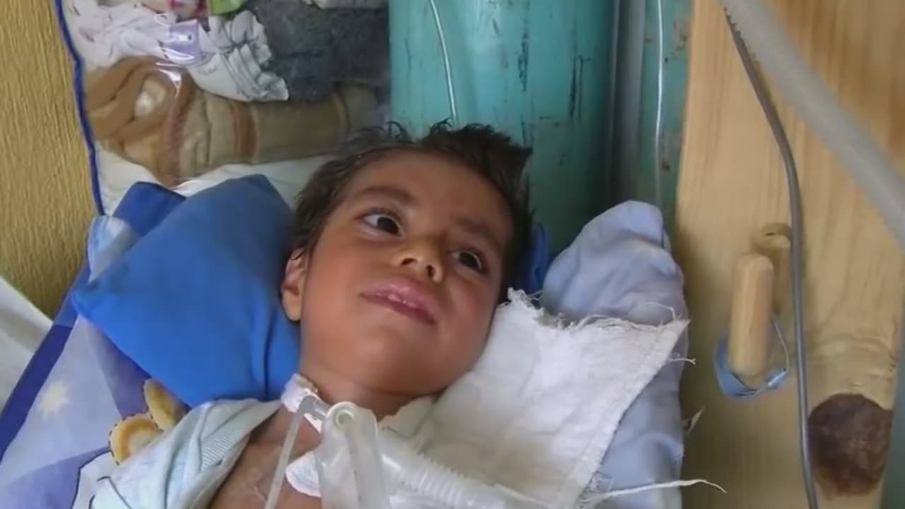 <b>Niño necesita un medicamento que cuesta 2 millones de dólares para poder vivir</b>
<br>
<br>Canek Zambrano es un niño mexicano que padece de atrofia muscular espinal tipo 1, la forma más aguda de una extraña enfermedad que tiene al pequeño conectado a un respirador y no puede moverse.