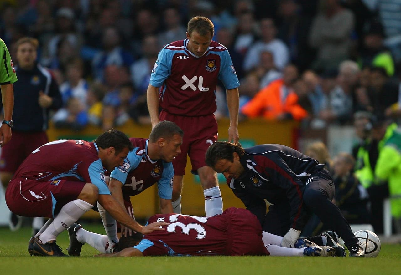Kieron Dyer, con West Ham, se rompió la pierna en dos partes y para regresar a jugar tuvo que pasar por 3 cirugías y más de 15 meses de recuperación.