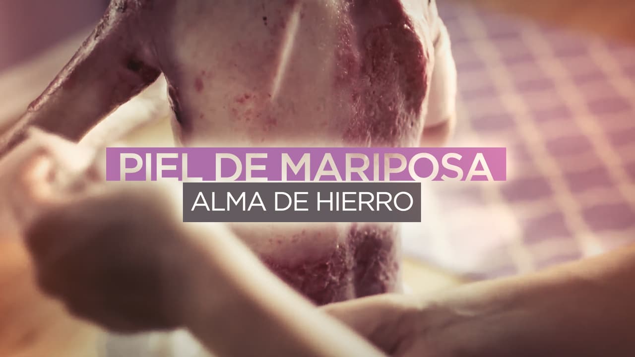 Piel de mariposa, alma de hierro PT1