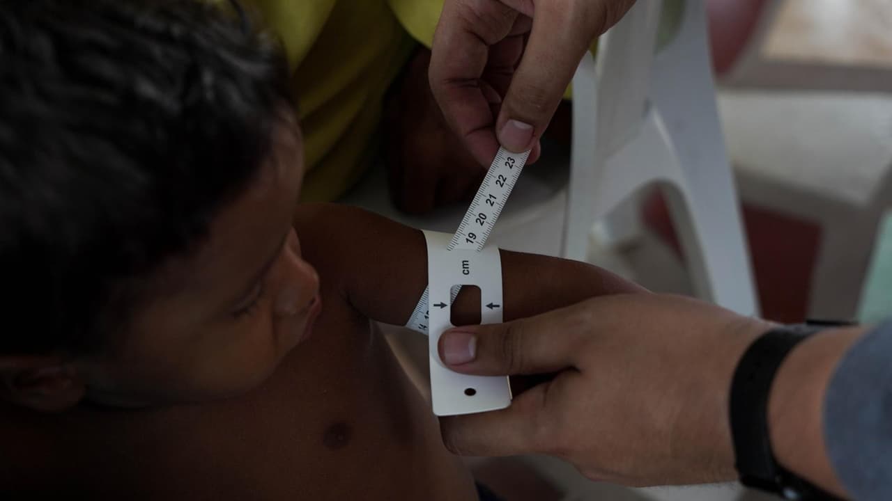 Los hijos de la mina: el drama de los niños desnutridos dejados atrás por mujeres que se van a las minas de oro en Venezuela