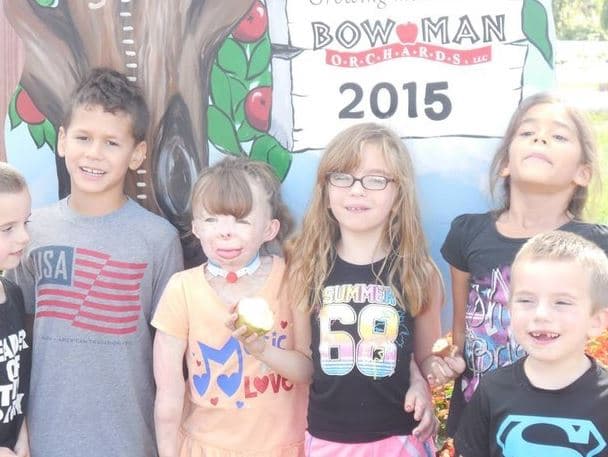 En los 2 años desde la tragedia, residentes locales han ayudado a Safyre para que su vida sea lo más normal posible.