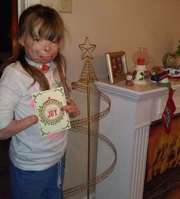 Su tía le compró un árbol para colgar tarjetas de Navidad pero necesita 100 de ellas para poder llenarlo.