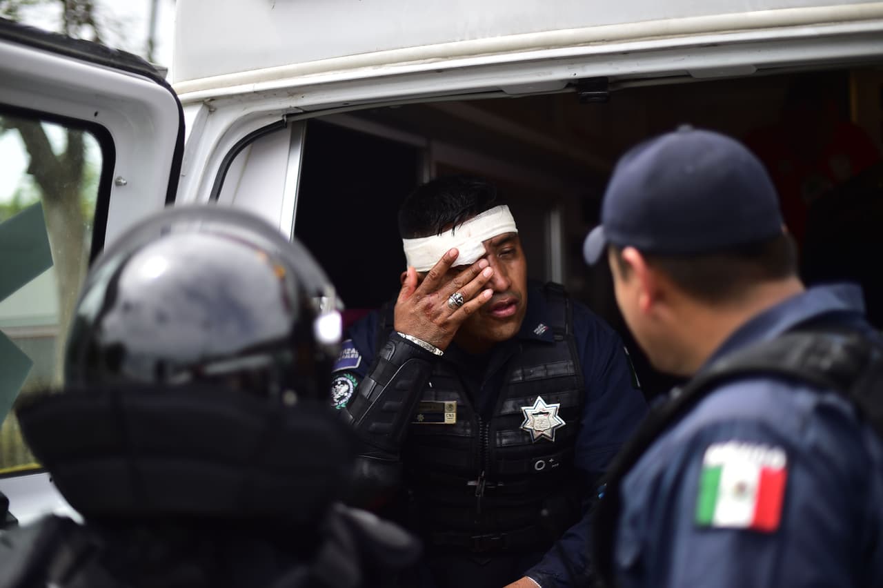 Un agente de la Policía Federal de México herido en el rostro después del breve enfrentamiento.