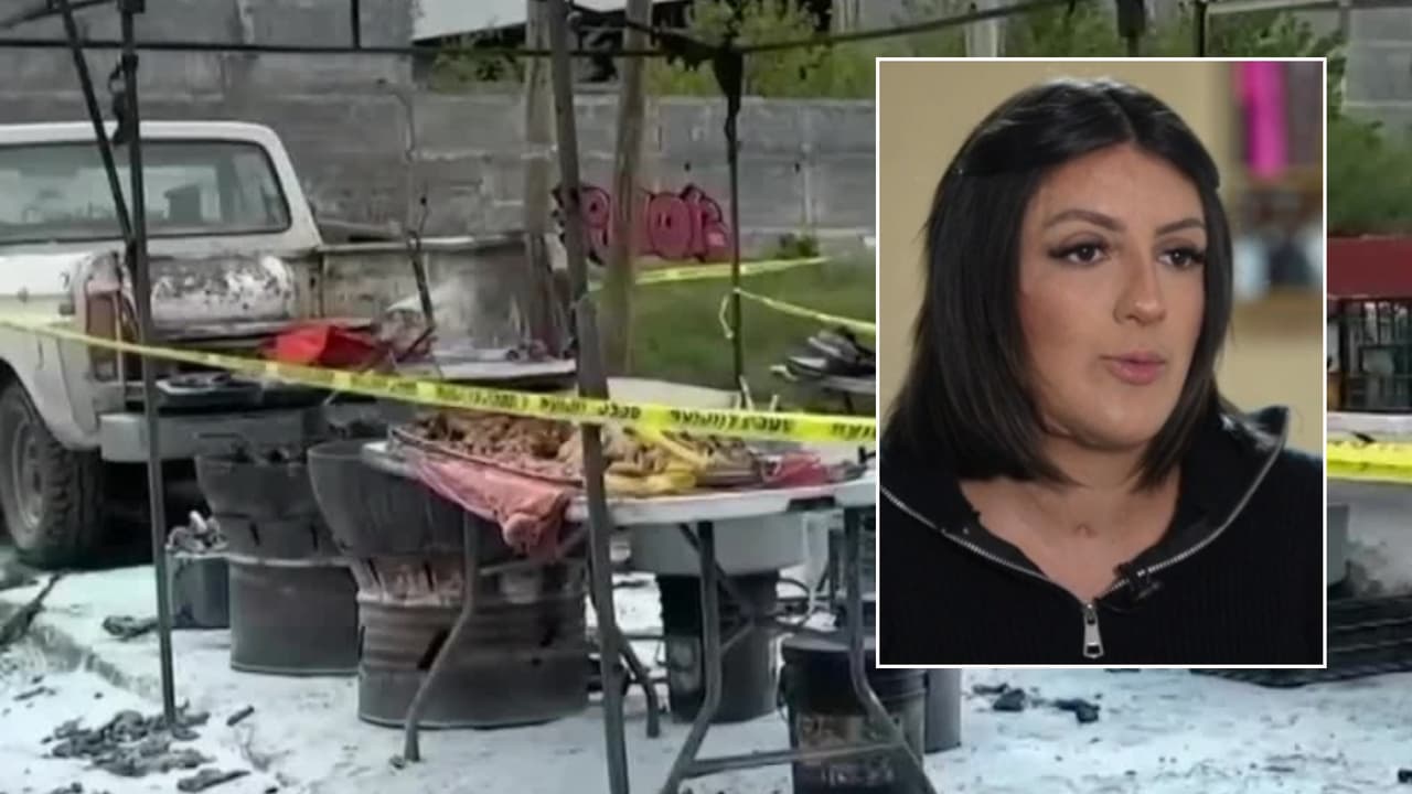 Una explosión cambió su vida: joven cuenta cómo sobrevivió y su lucha tras quedar gravemente quemada