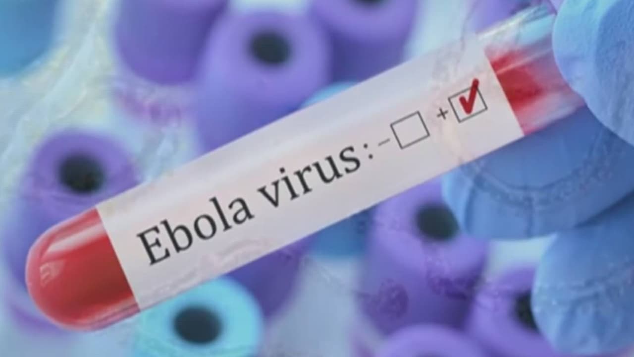 ¿Cuáles son los síntomas del ébola? ¿Hay riesgo de que se propague en EEUU?