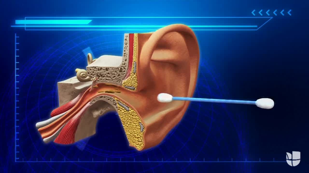Usar hisopos de algodón no es bueno para la salud de los oídos