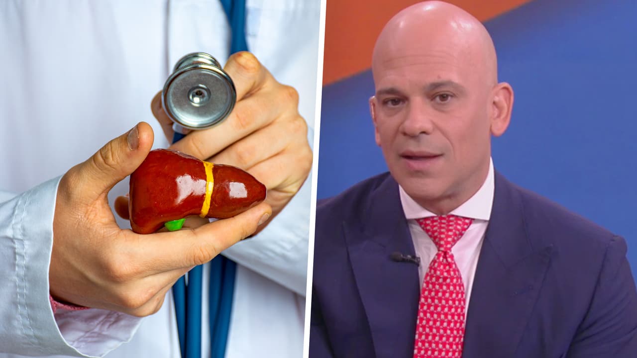 Hígado graso: Dr. Juan explica por qué sucede y cómo detectarlo