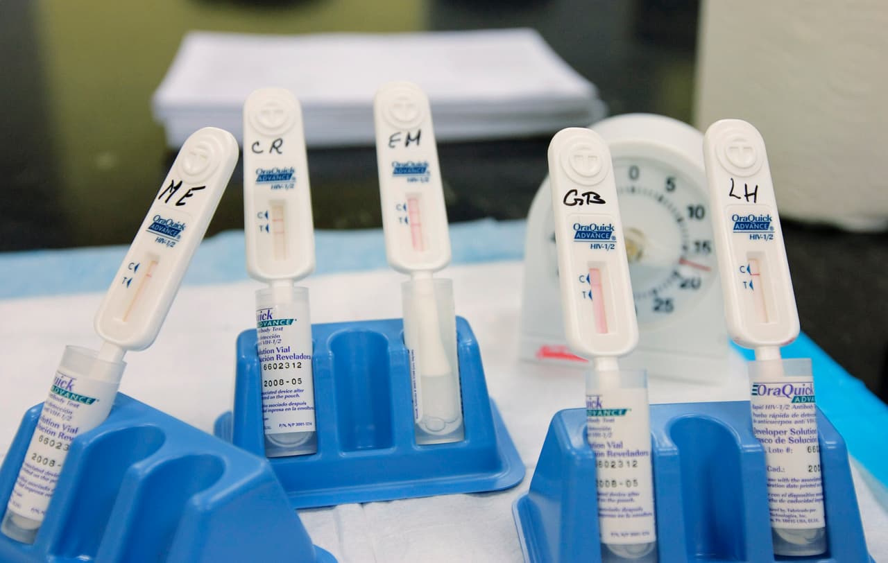 Diagnósticos de VIH descienden a niveles record en la ciudad de Nueva York