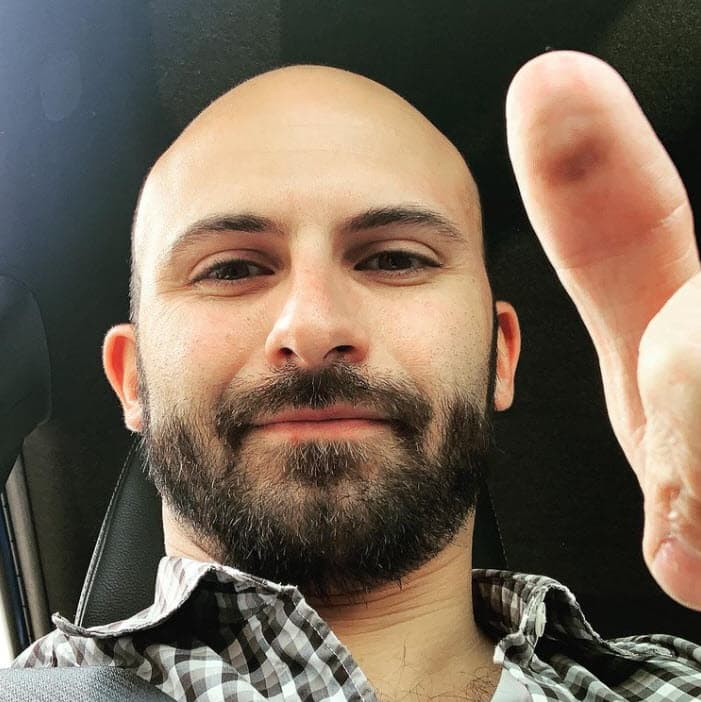 Con esta carga genética, Imanol Landeta repitió la historia de su padre y de su hermano: "A los 22 o 23 años ya se me veía la 'lona' (cuero cabelludo) y teníamos que estar
<b>haciendo malabares </b>para que pareciera que todavía tenía una gran mata", contó el joven, ahora de 34 años.
<br>