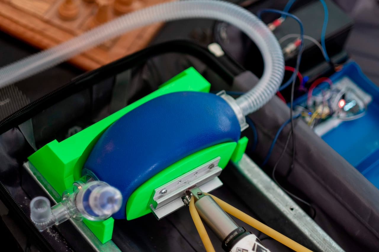 El prototipo de un ventilador mecánico en el que el Dr. Jonathan Alistair está trabajando actualmente.