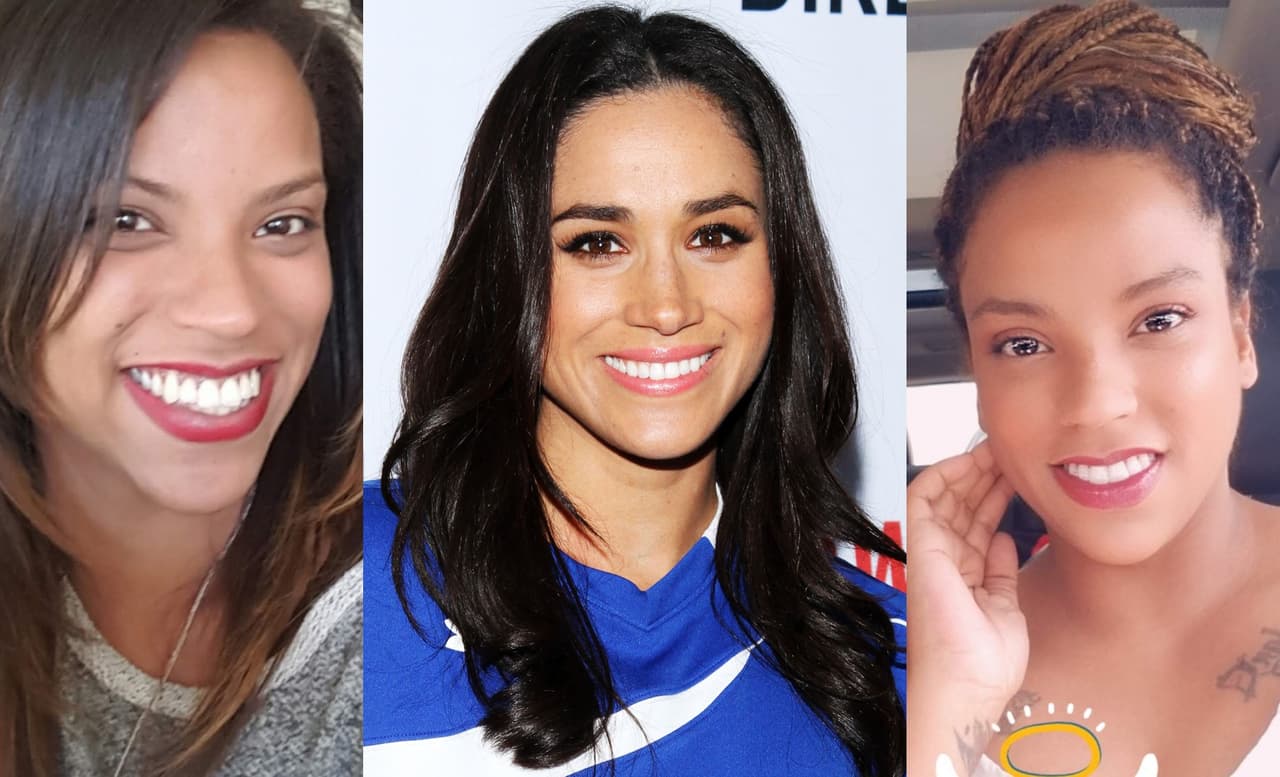 Williams pidió una cirugía que la ‘asimilara’ un poco a ella “porque las dos somos birraciales, y sentía que ya teníamos algunas cosas en común… Fue una inspiración más que (un objetivo) verme como ella”.
<br>