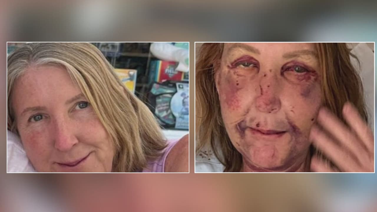 Dos mujeres brutalmente atacadas en Venice: fiscal ordena que el acusado no tenga fianza