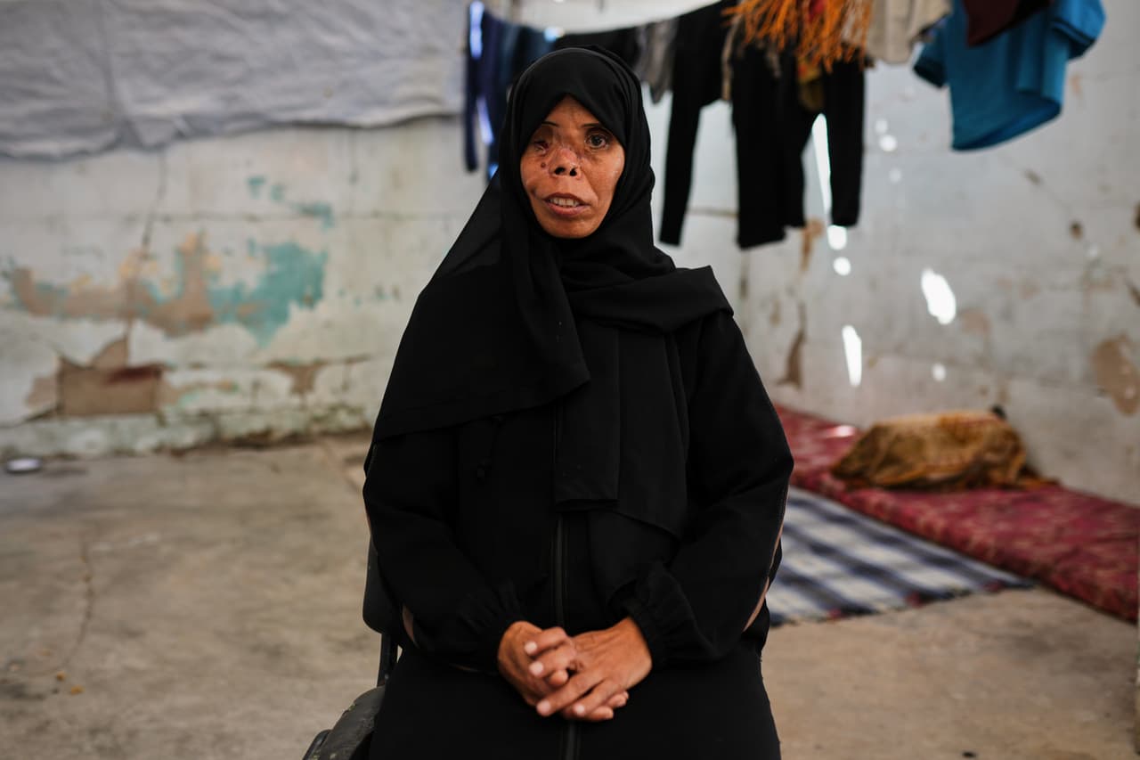 Najwa Abu Eita, quien resultó herida en un bombardeo del ejército israelí durante la guerra entre Israel y Hamás y perdió a su hija de 7 años en 2024, posa para una fotografía en su tienda de campaña en Nuseirat, en el centro de Gaza, el martes 6 de octubre de 2026.