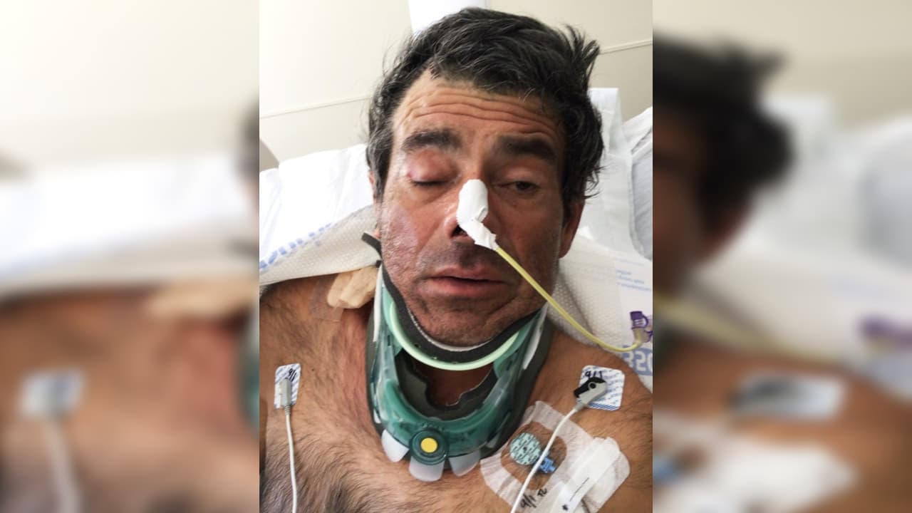 Habla español, pero no recuerda quién es: el hombre desconocido que lleva casi un mes en un hospital de California