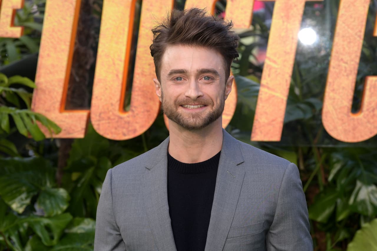 <b>Daniel Radcliffe</b>
<br>El actor famoso por su interpretación como Harry Potter en la saga de películas homónimas tiene un parecido físico con el personaje de los cómics y no solo por sus rasgos físicos, también por la altura (5.5 pies), pues en las páginas de Marvel Logan mide 5.3 pies, a diferencia de los 6.2 pies que mide Hugh Jackman.