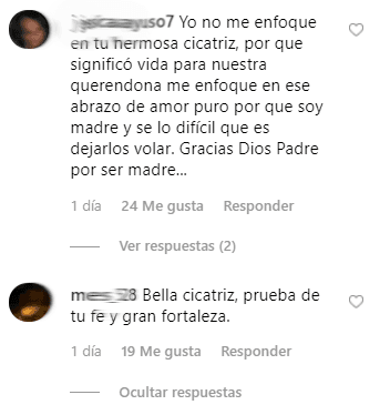 Hasta el momento, la fotografía lleva más de 85,000 'likes' y algunos de sus admiradores notaron la cicatriz en su pierna derecha, por lo que no dudaron en escribirle mensajes de apoyo.