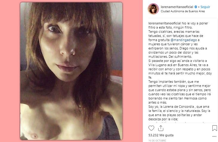 A mediados de octubre de 2018, Lorena compartió esta imagen donde mostró sus senos reconstruidos tras haberse tatuado las areolas mamarias. Fue gracias a la ayuda del tatuador Diego Mandinga, quien ayuda a mujeres que han padecido cáncer y les tatúa las areloas y los pezones para terminar con las reconstrucciones, que Lorena recuperó el aspecto de sus pechos.