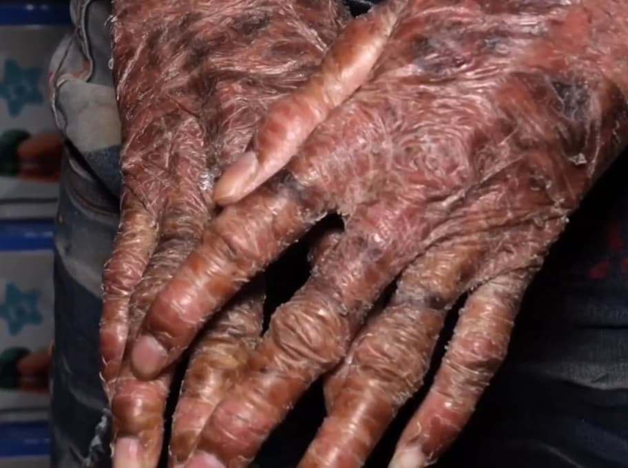 “También los grandes lo rechazaban, ha sido un trago muy amargo”, afirma Tejada. 
<br>