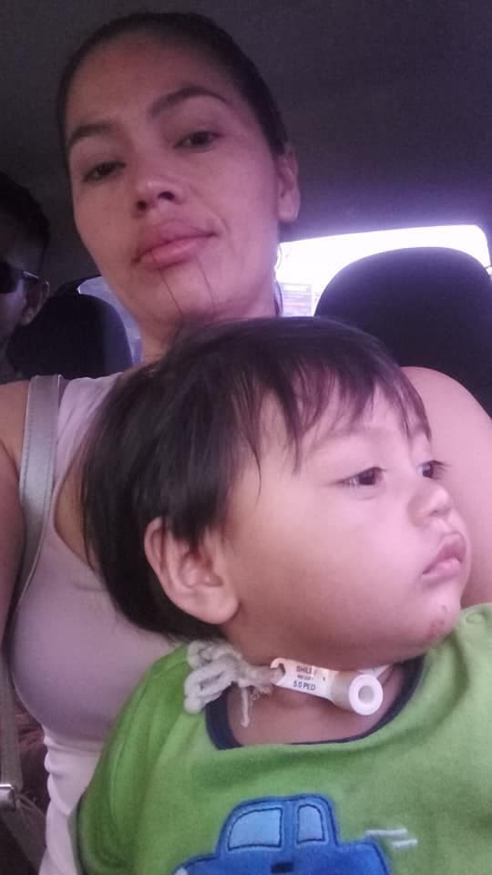 La recuperación de William se extendió desde mayo, cuando resultó herido, hasta noviembre.