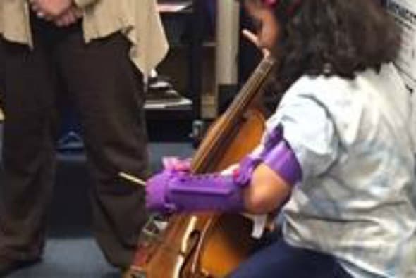 Gracias a su dedicación, una compañía les dio los planos de una prótesis y ella los imprimió en 3D. Una asocación sin fines de lucro les ayudó con fondos para hacerlo.