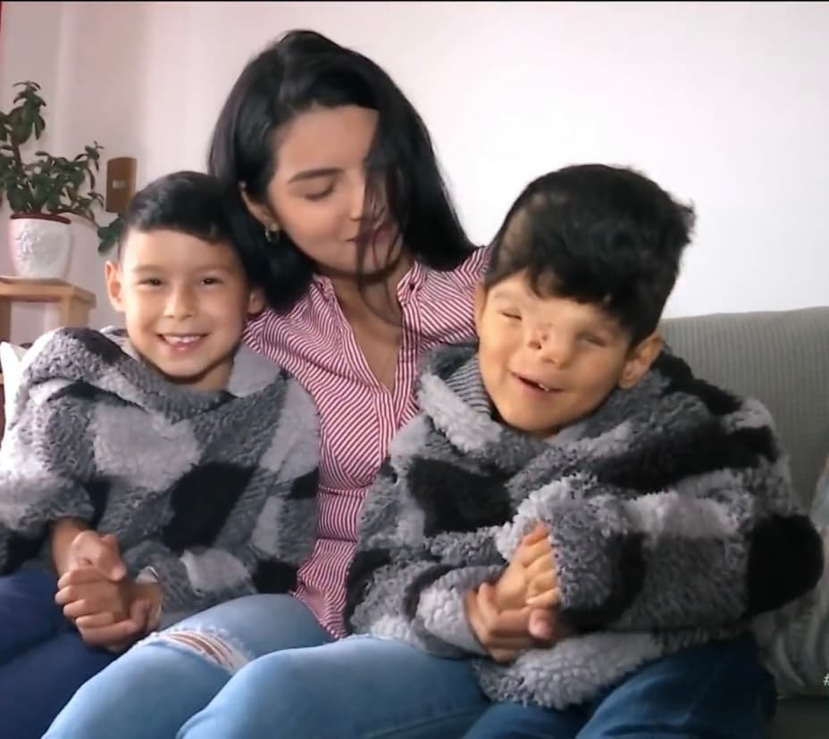 Martinez, una madre venezolana, lleva seis años luchando una dura batalla, junto a uno de sus gemelos,
<b> quien nació con una compleja malformación craneofacial</b>, de la que ningún especialista ha sabido explicar su origen.