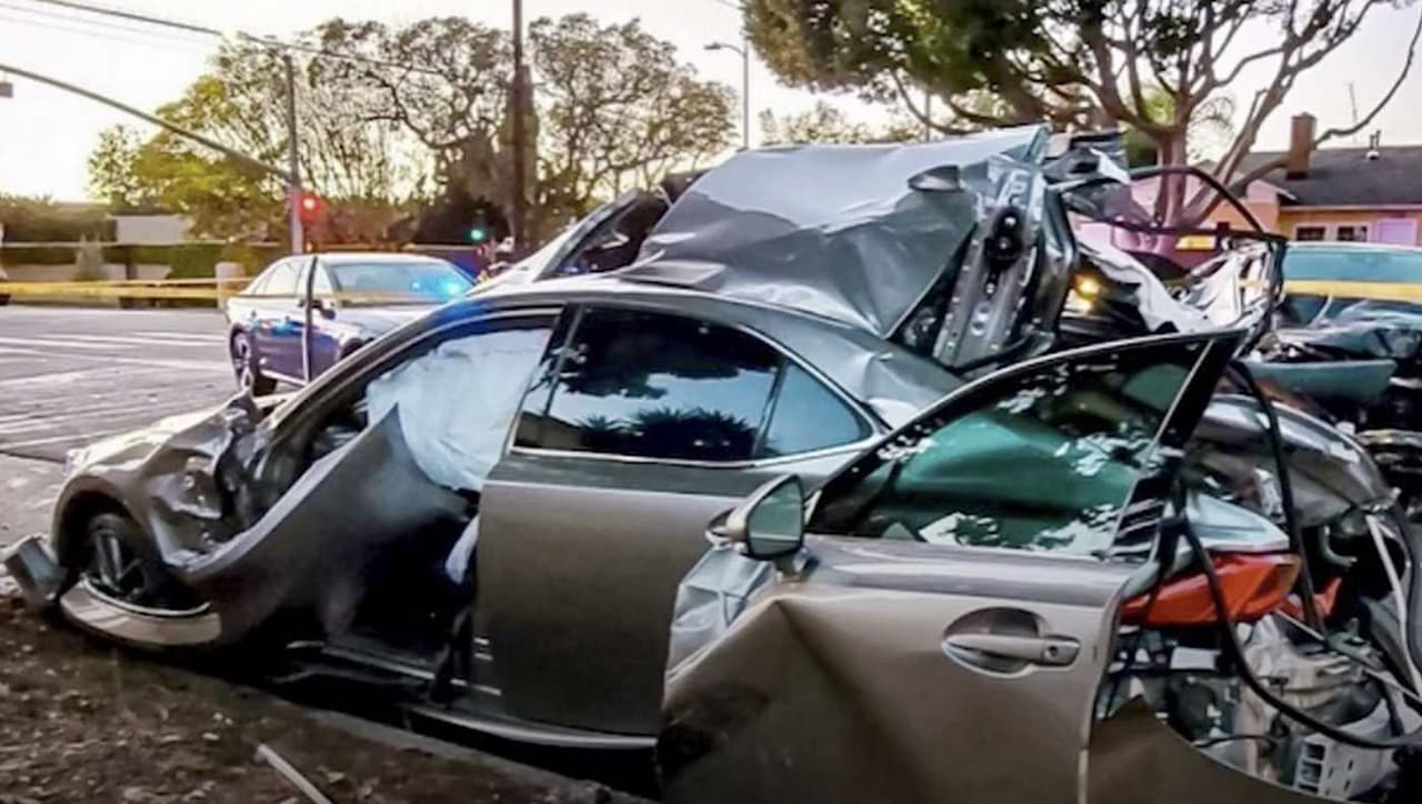 El menor de de 17 años de edad, al parecer fue hospitalizado debido a una fractura cerebral ocrurrida debido al accidente.