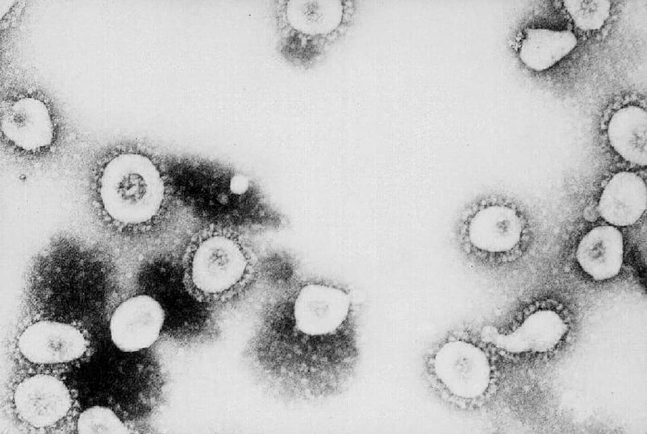 Anuncian posible caso de coronavirus en la Universidad de Chicago: sería el quinto caso del virus en Illinois