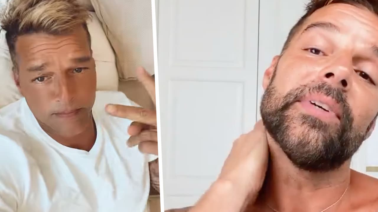Ricky Martin asegura tener dermatitis mientras muchos hablan de que se hizo otra cirugía