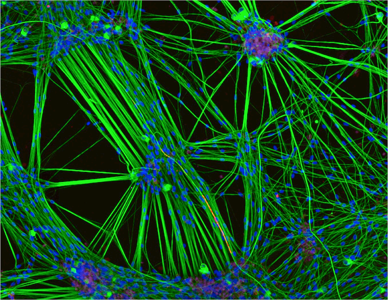 Tercer premio: Neuronas derivadas de la piel. Rebecca Nutbrown (Reino Unido) — Aumento: 20x