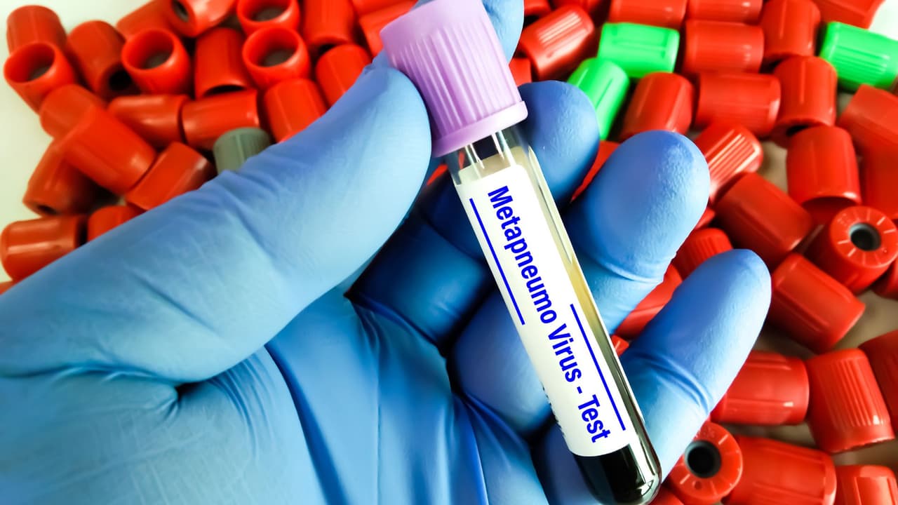 Actualmente, no existe una terapia antiviral específica para tratar el metapneumovirus
<b> </b>ni una vacuna para prevenir el HMPV. La atención médica es de apoyo.
<br>