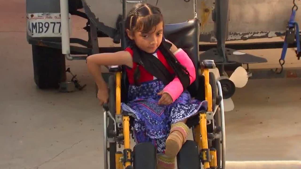 La inspiradora historia de la niña de “huesos de cristal” que llegó a EEUU para tratar su extraña enfermedad