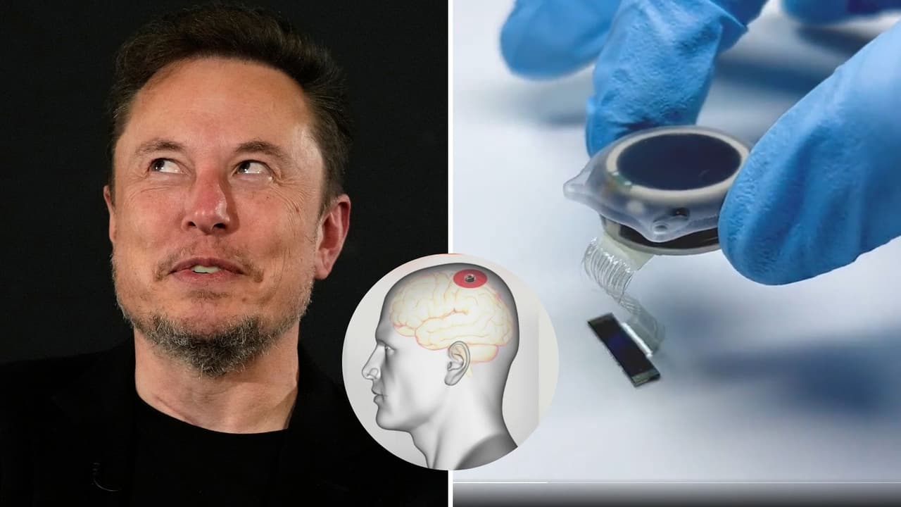 Elon Musk anuncia que su empresa Neuralink ya implantó el primer chip cerebral en un humano a pesar de polémicas