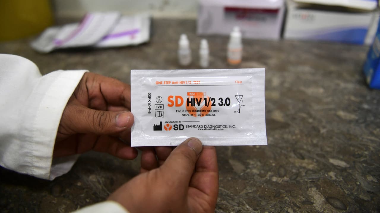 Día Nacional de la Prueba de VIH: mira dónde puedes realizarte una prueba de detección gratuita