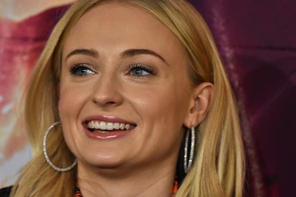 "Creo que de alguna manera eso salvó mi vida", aseguró Turner.