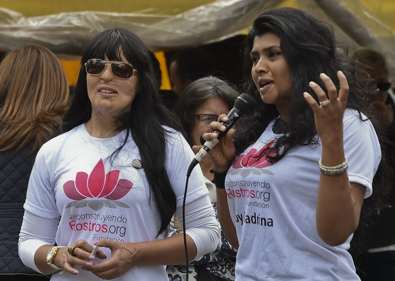 Como una de las primeras víctimas de estos ataques en el país, Gina Potes (derecha) puso en marcha la Fundación Reconstruyendo Rostros para ayudar a otras mujeres y para concienciar de la generalización de la violencia en su país. Además, víctimas como ella han conseguido que las compañías que fabrican los productos de limpieza que usan algunos agresores quiten los componentes más nocivos de sus productos.