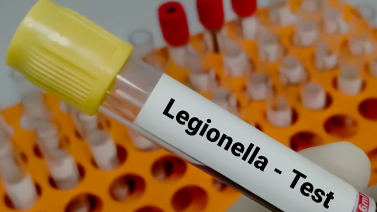 Confirman una muerte por la enfermedad del legionario en Nueva York: esto se sabe